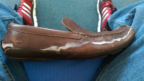 Leather shoes are not ideal for formal occasions they can. How do I remove salt stains from leather shoes? Need help ...