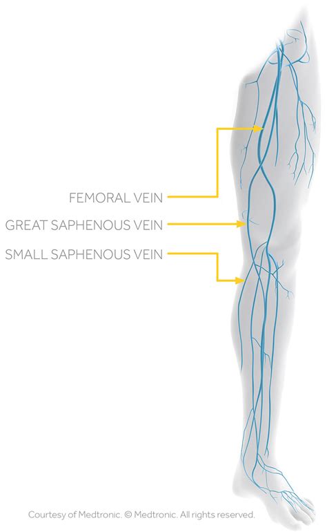 Venous Reflux And Ultrasound The Vein Institute Of Blue Bell