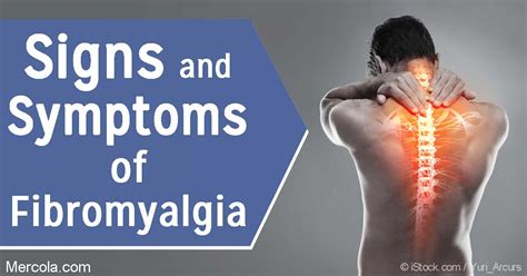 What Are The Symptoms Of Fibromyalgia