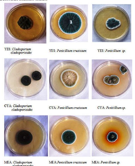 Colonial And Morphological Characteristics Of Various Fungi Species