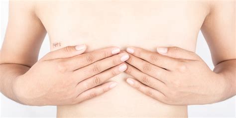 Choosing Breast Reconstruction After A Mastectomy