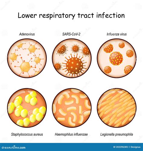 Respiratory Infection Close Up Of Viruses And Bacteria Stock Vector