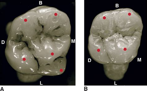 Type Traits That Differentiate Maxillary Second From First Molars