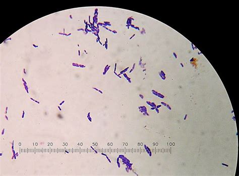 Phase contrast compound microscope is the best suitable to visualize bacterial structures accurately. day 243 - bacillus cereus | Microbiology, Protists ...