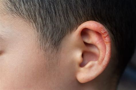 Does The Inside Of Your Ear Itch Here S What It Means And How To Treat It