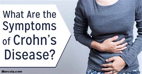 What Are The Symptoms Of Crohns Disease
