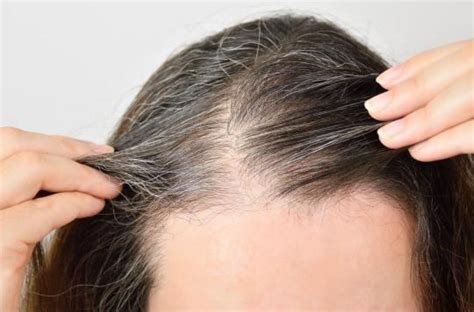 Le stress nous fait bien des cheveux blancs