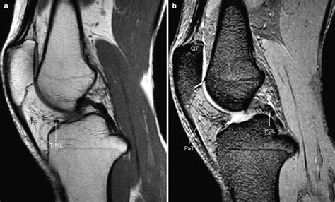 Anatomy Of The Knee Radiology Key