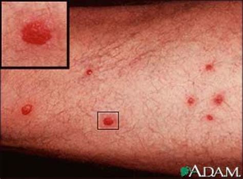 13 Causes Of Red Spots On Skin