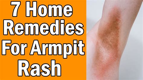 7 Home Remedies For Armpit Rash Youtube