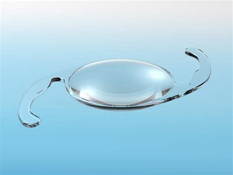 what to know about intraocular lenses for cataract surgery