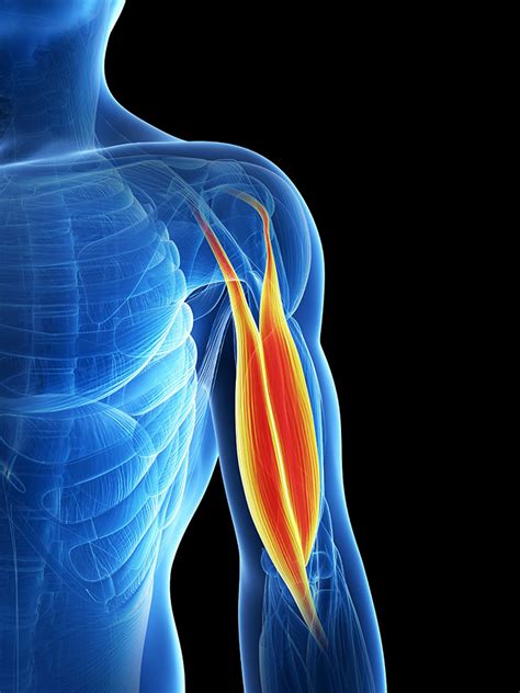 Upper Arm Pain Causes Symptoms Upper Arm Injuries Physio Pretoria
