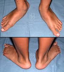 This is what happens to the soles of your feet when they are flat. 6 Bad Postures That Are Ruining Your Health & How To ...