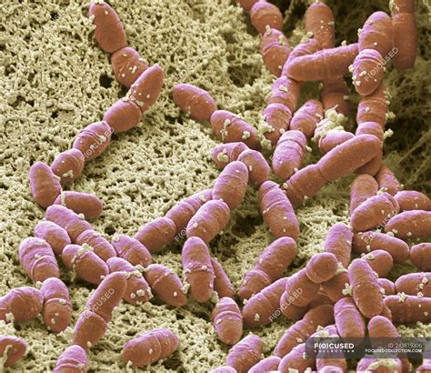 Colored Scanning Electron Micrograph Of Streptococcus Mutans Anaerobic