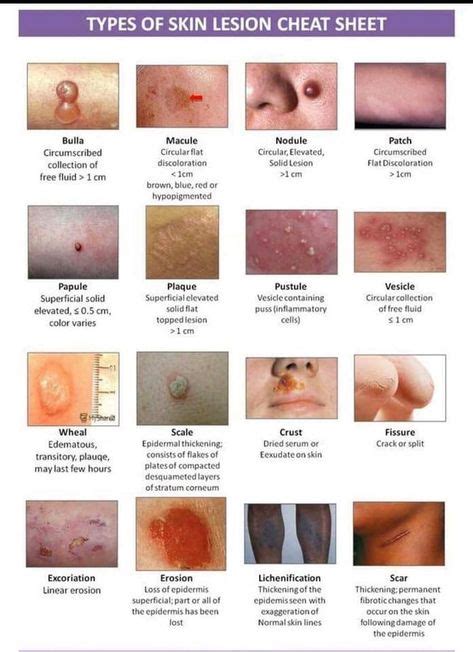 33 Dermatology Ideas Dermatology Nursing Study Medical Knowledge