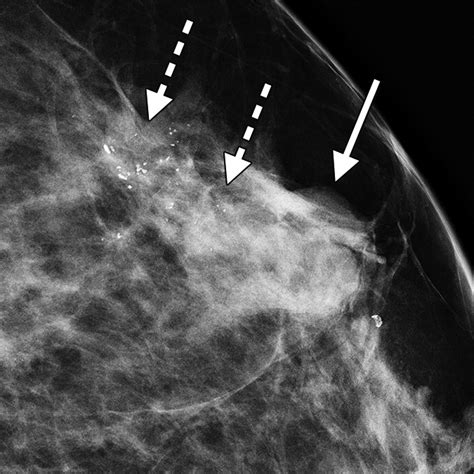 Correlation Between Sonographic Findings And Clinicopathologic And