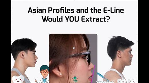 Asian Profiles And The E Line Would You Extract Youtube