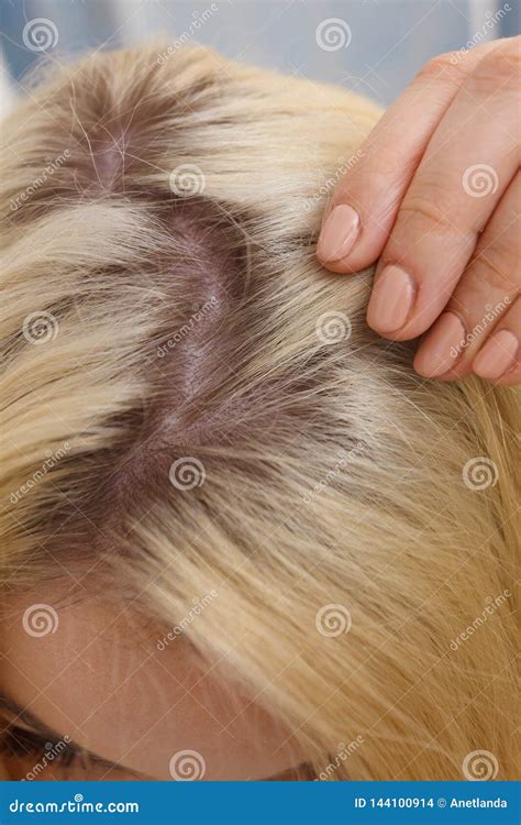 Woman Showing Blonde Hair Roots Stock Photo Image Of Female Root