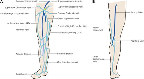 Ultrasound Evaluation Of The Lower Extremity Veins Radiologic Clinics