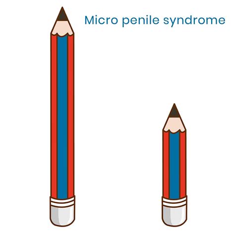 Micro Penile Syndrome Small Penis Problem Metromale Clinic Fertility Center