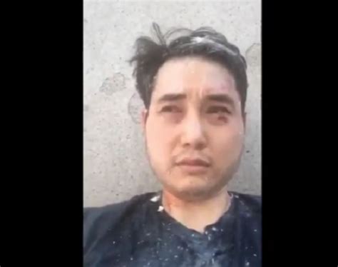 Antifa Thugs Attack And Beat Independent Journalist Andy Ngo In Portland—while Police Do Nothing