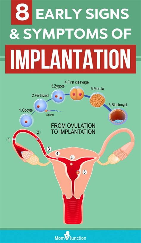 8 Early Signs And Symptoms Of Pregnancy Implantation Early Pregnancy