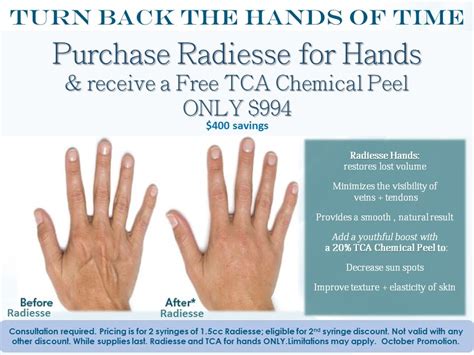 Take Back The Hands Of Time With Our Combination Treatment Of Radiesse