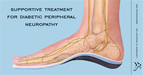 The feet are a good barometer of thyroid health. Diabetic Peripheral Neuropathy Treatment with Orthotics ...