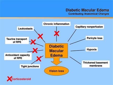 Ppt Diabetic Macular Edema 2010 Powerpoint Presentation Id641843