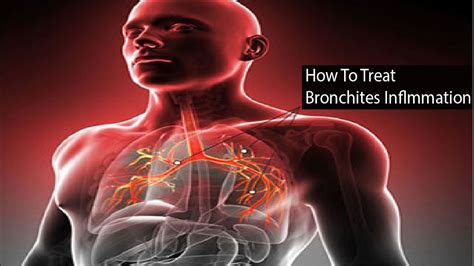 How To Treat Bronchitis Treatment For Bronchitis Youtube