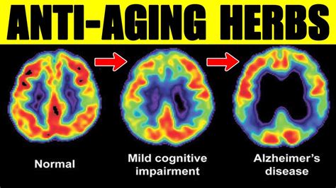 9 Best Anti Aging Herbs That Helps Protect The Brain And Memory Loss