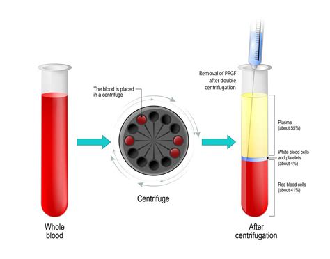 Centrifuge Blood Separation
