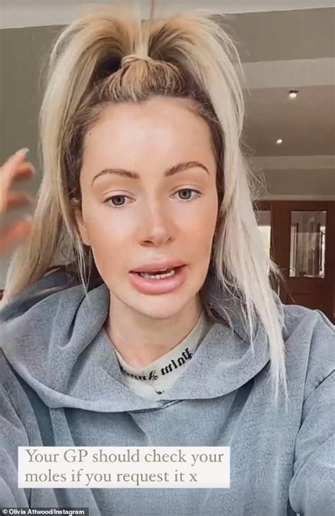 Olivia Attwood Has Mole On Her Back Removed And Urges Her Fans To Be