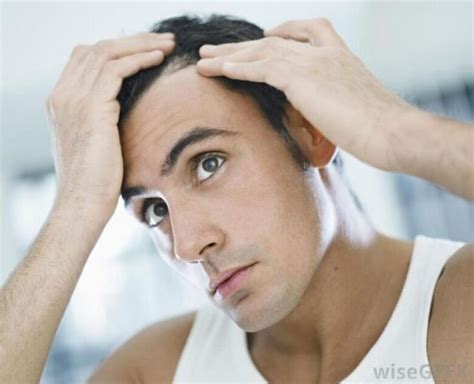 6 Reasons Why Men End Up Losing Their Hair Demotix