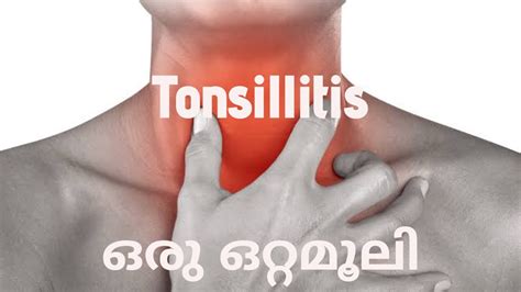 തൊണ്ട വേദനക്ക് ഒരു ഒറ്റമൂലി Tonsillitis Youtube