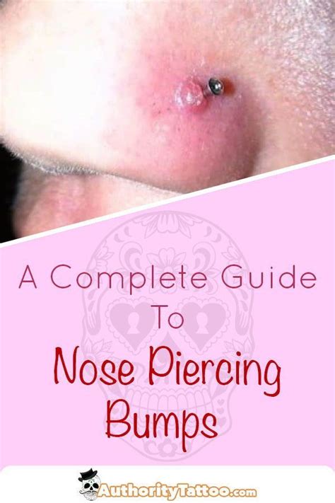 Nose Piercing Bumps Are Very Common But Also Extremely Unsightly We Delve Into The Mysteries Of