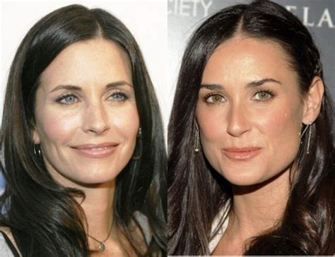 Most Expensive Celebrity Plastic Surgeries Ever And How Much They Cost Wikiace