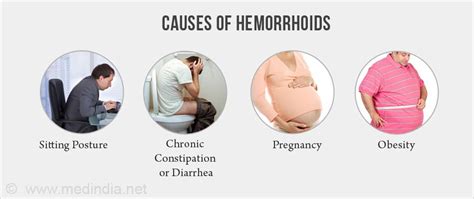 Symptoms And Causes Of Hemorrhoids