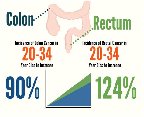 5 Things Young People Should Know About Colorectal Cancer Roswell