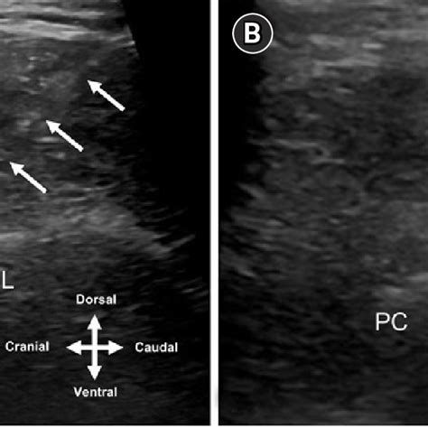 Real Time Ultrasound Views For Needle Insertion A And Epidural