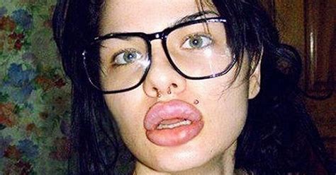 Woman Blows On Lip Boosters But Says Pout Is Still Too Small Mirror Online