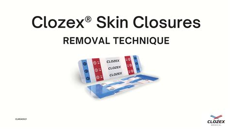 Clozex Skin Closures Removal Technique Youtube
