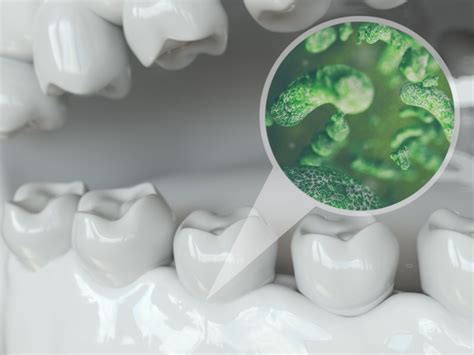 How Many Kinds Of Bacteria Are In The Mouth Waters Edge Dental