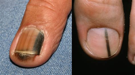What That Weird Dent Or Blotch On Your Nail Might Be Saying About Your