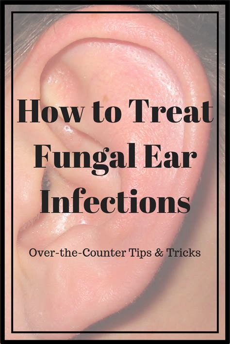 Respiratory fungal infection is a severe clinical problem, especially in patients with compromised immune functions. How to Treat Fungal Ear Infections | Ear infection remedy ...