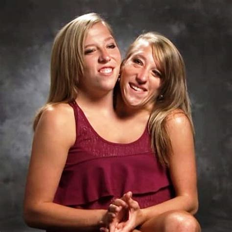 Are Abby And Brittany Hensel Conjoined Twins Married Legsbm
