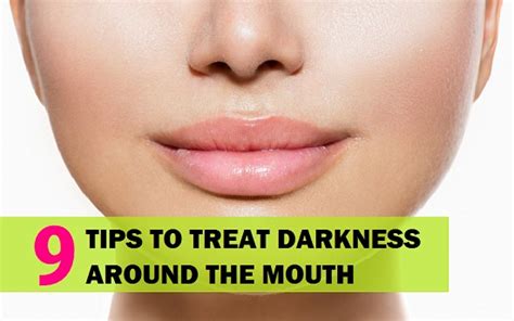 9 Best Home Remedies For Darkness Around Mouth And Lips