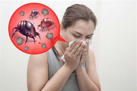 Dust Mite Allergy Symptoms Treatments And Prevention Pest Wiki