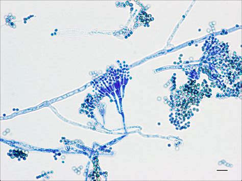 Penicillium Under Microscope