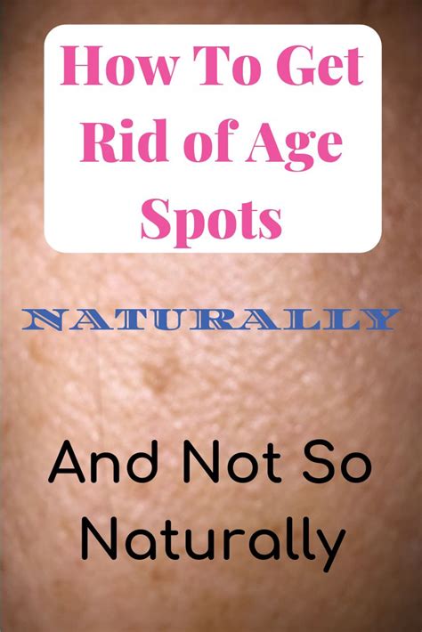 How To Get Rid Of Age Spots Naturally And Not So Naturally Age